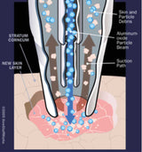 Silhouet-Tone Vortex Peel Microdermabrasion Unit | Luxury Dual-System Skin Resurfacing
